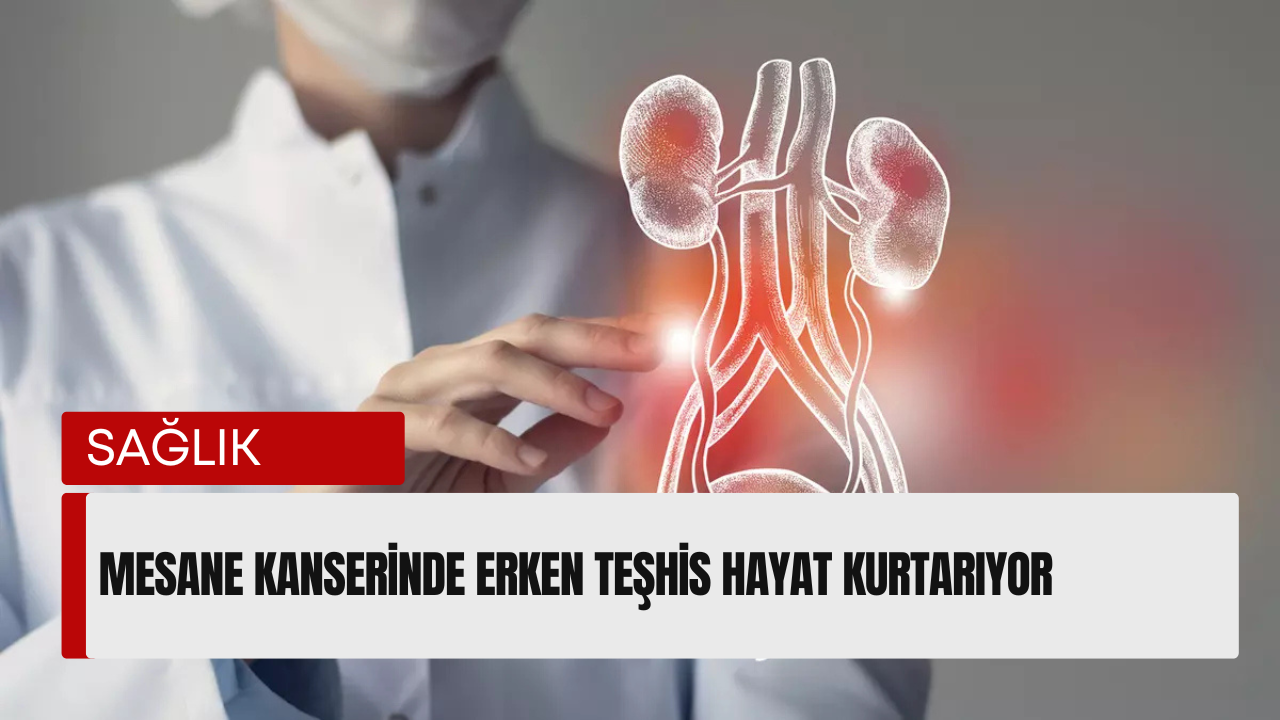 mesane kanseri